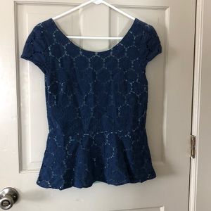 ADORABLE zipper back peplum